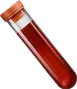 Blood Sample عينة دم